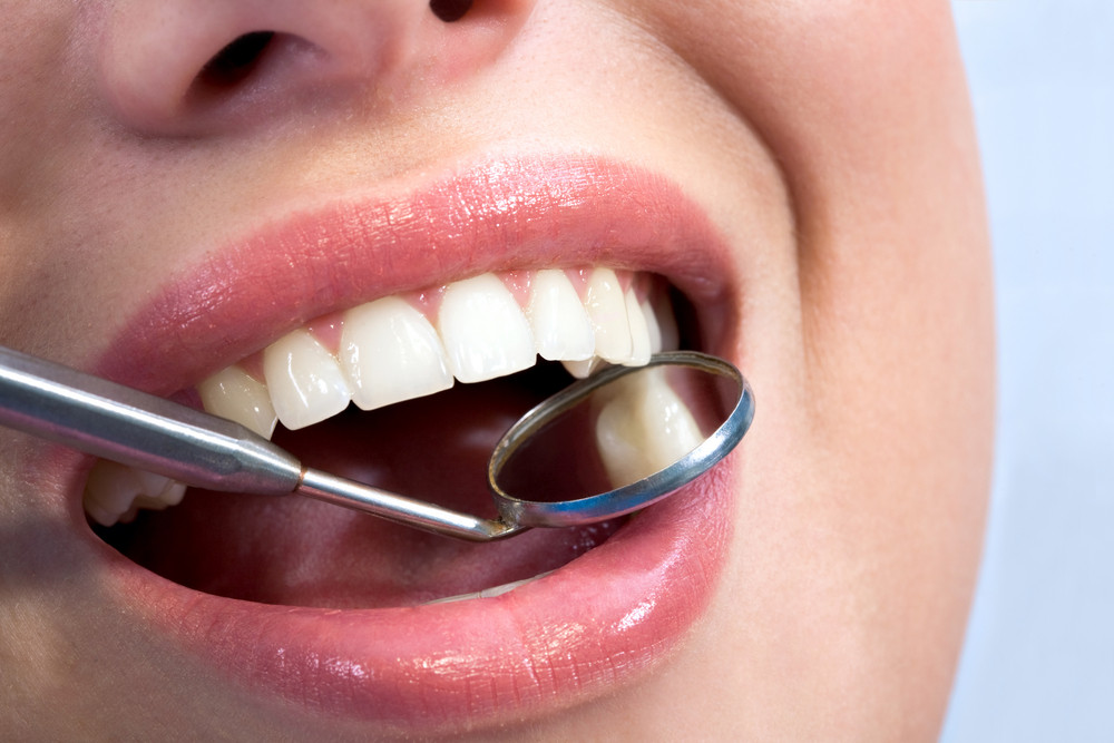 4 Signs You’ve Found a Great Local Dentist